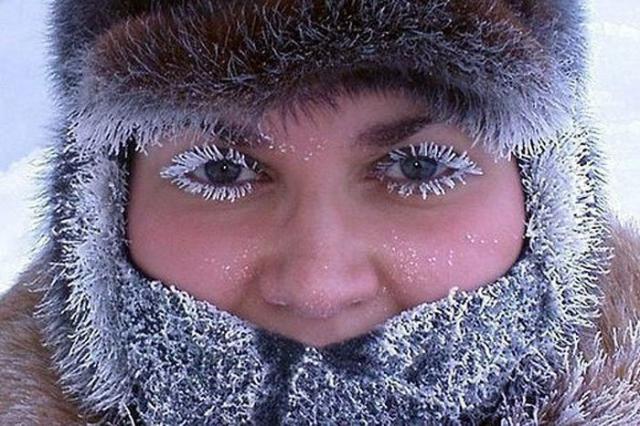 Что делать при обморожении